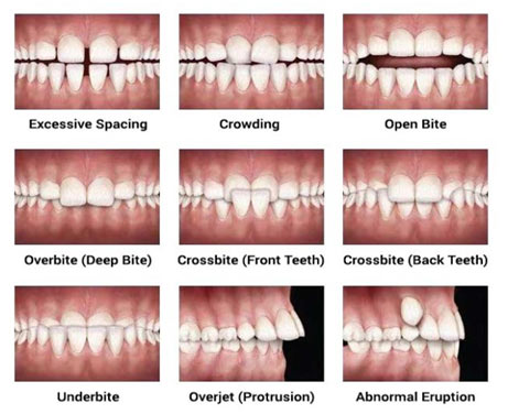 Orthodontics / Braces